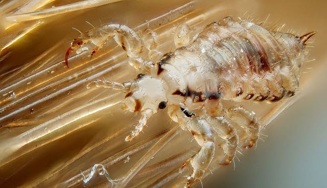 Head Lice: Symptoms and Risk Factors head louse