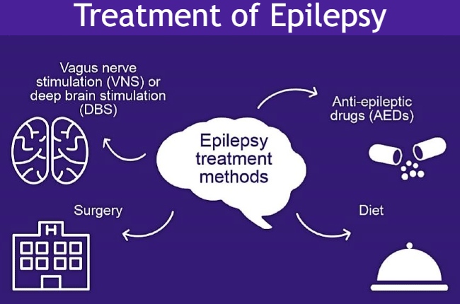 How to treat Epilepsy and Seizure Disorders treatment of epilepsy